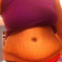3 1/2 weeks post op