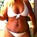 Post Op 8 days Swollen but not so bad. Don't wear a compression garmet. Wondering why the need?