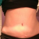 Eleven weeks post op, end of day swelling