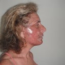 Moisturise, moisturise, moisturise
