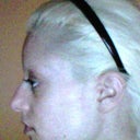 before - lateral view
