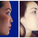 Before & After
(TODAY)