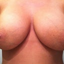 Front before