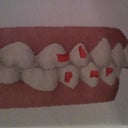 3-D Before - Side angle shot