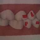 3-D After - Side angle shot