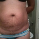 I should of submitted  this pic earlier ... This was taken out before my surgery.. Wanted to share it...