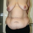 December 06, 2010 pre-op