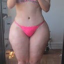 4 months post op
