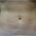 Front view after