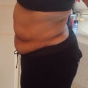 Pre op profile view