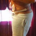 post op day 2 side view