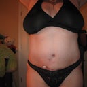 11 weeks post-op