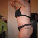 11 weeks post-op