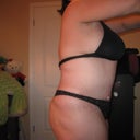 11 weeks post-op