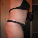 11 weeks post-op