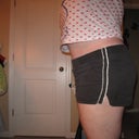 11 weeks post-op