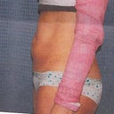 Scanned Picture Taken Before Procedure