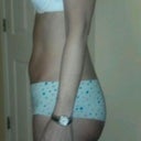 Picture at 3 weeks post procedure