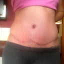 7wks PO
