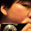 August 28, 2012 - A month after second procedure

Left side of my face reflected in a mirror