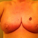 Week Three Post Op