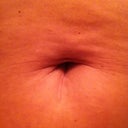 that used to be a cute little pierced belly button.  Now it is a collapsed mess with a scar coming out of it.