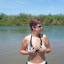 This is me over a year after surgery!