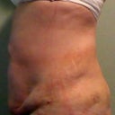 Day 9, left side