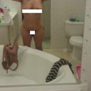 8 days post op