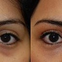 Before and After