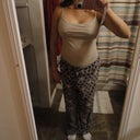 End of week 3..Still swollen.
