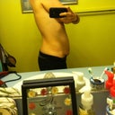 Side View Pre Op