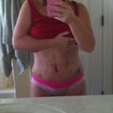 Post op day 3, front