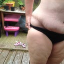swelling mostly on this side