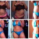 Before and 1 week post op on the top and on the bottom row is 2 weeks post op.  The uneven dimpling I had on the left side of my abs after the TT is smoothing out nicely.  I was worried it was going to require more lipo to smooth it out.