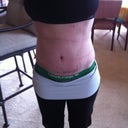 12 Days PO with Scar