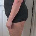 These are all my before pictures. I am 5'7". 185 lbs. I have a saggy barely "B" sized bust and horribly strtched out stomache. With each child, the stretchmarks got higher.