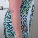 before.....cant fill out the top of my dress