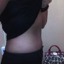 Before smart lipo