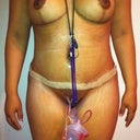 day 8 post op