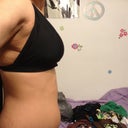 Trying on my bathing suit that I used to always bulge out of pre-surgery