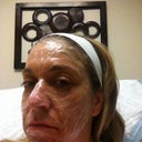 Numbing cream