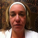 Treatment 1-post fraxel 15 minutes