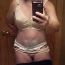 PO Day 3 - you can see how swollen I am especially around the belly button area.