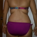 1 day before procedure