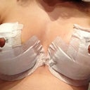 A close up shot-the bandages are starting to peel away, but they come off on thursday