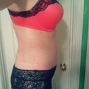 still swollen but feeling good and ooooh so happy