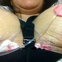 My right boob is much more swelled up than the left