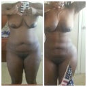 Before/After