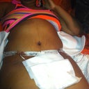 Swelling  going down drains are doing there job!!!
